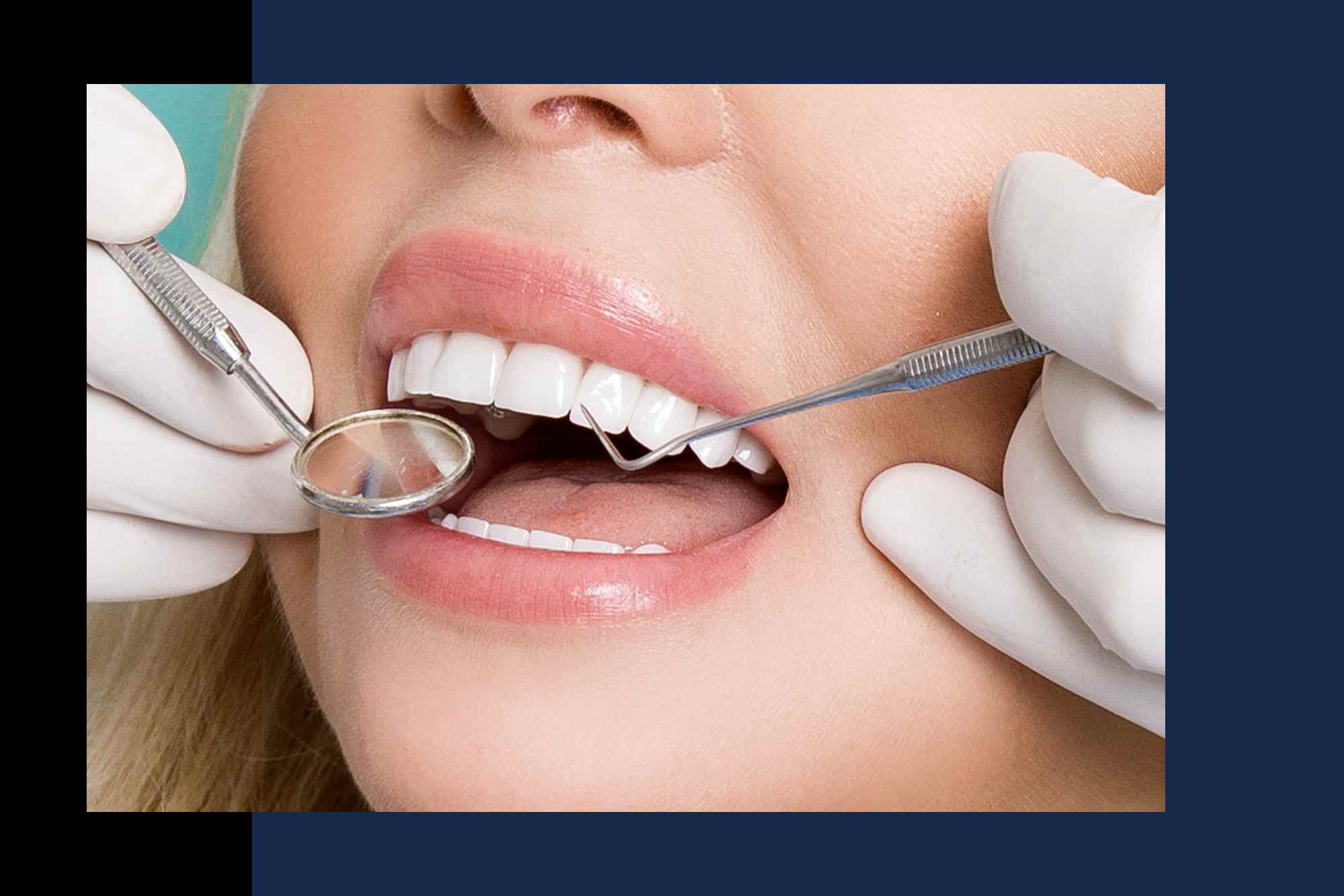 Cosmetic Dentist in Duncan SC