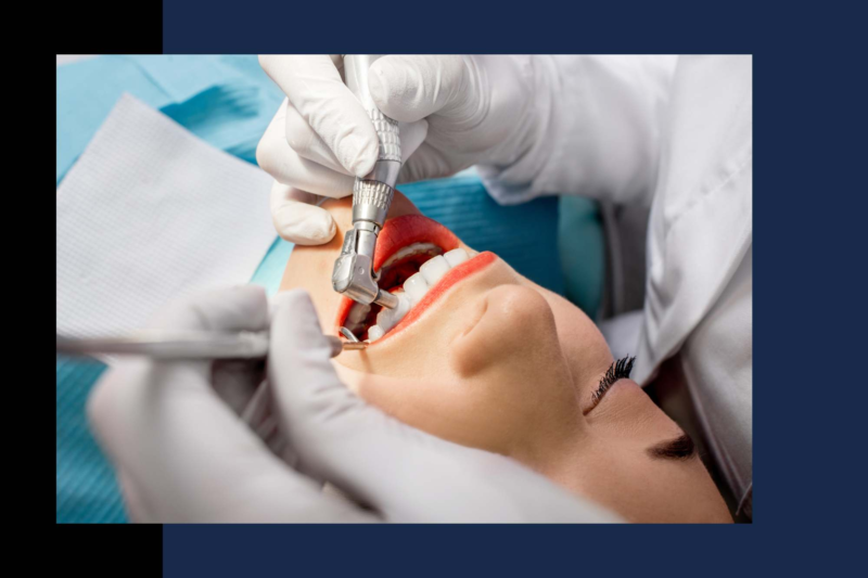 Teeth Cleaning Duncan SC Teeth Cleaning Near You