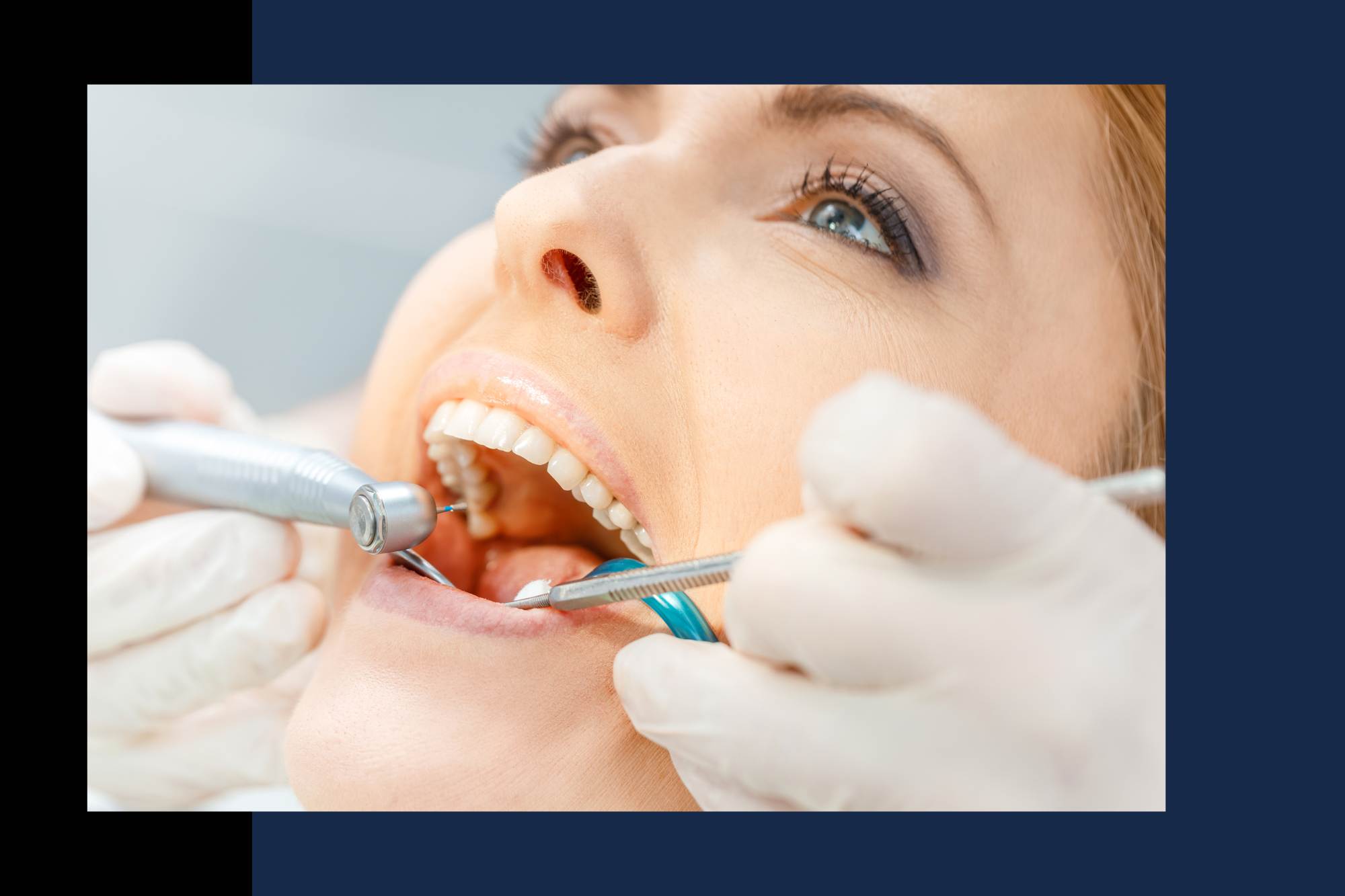 Dental Implant Restoration Duncan SC