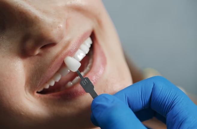 Cosmetic Dentistry - Smiles