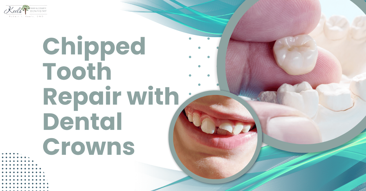 Chipped Tooth Repair with Dental Crowns
