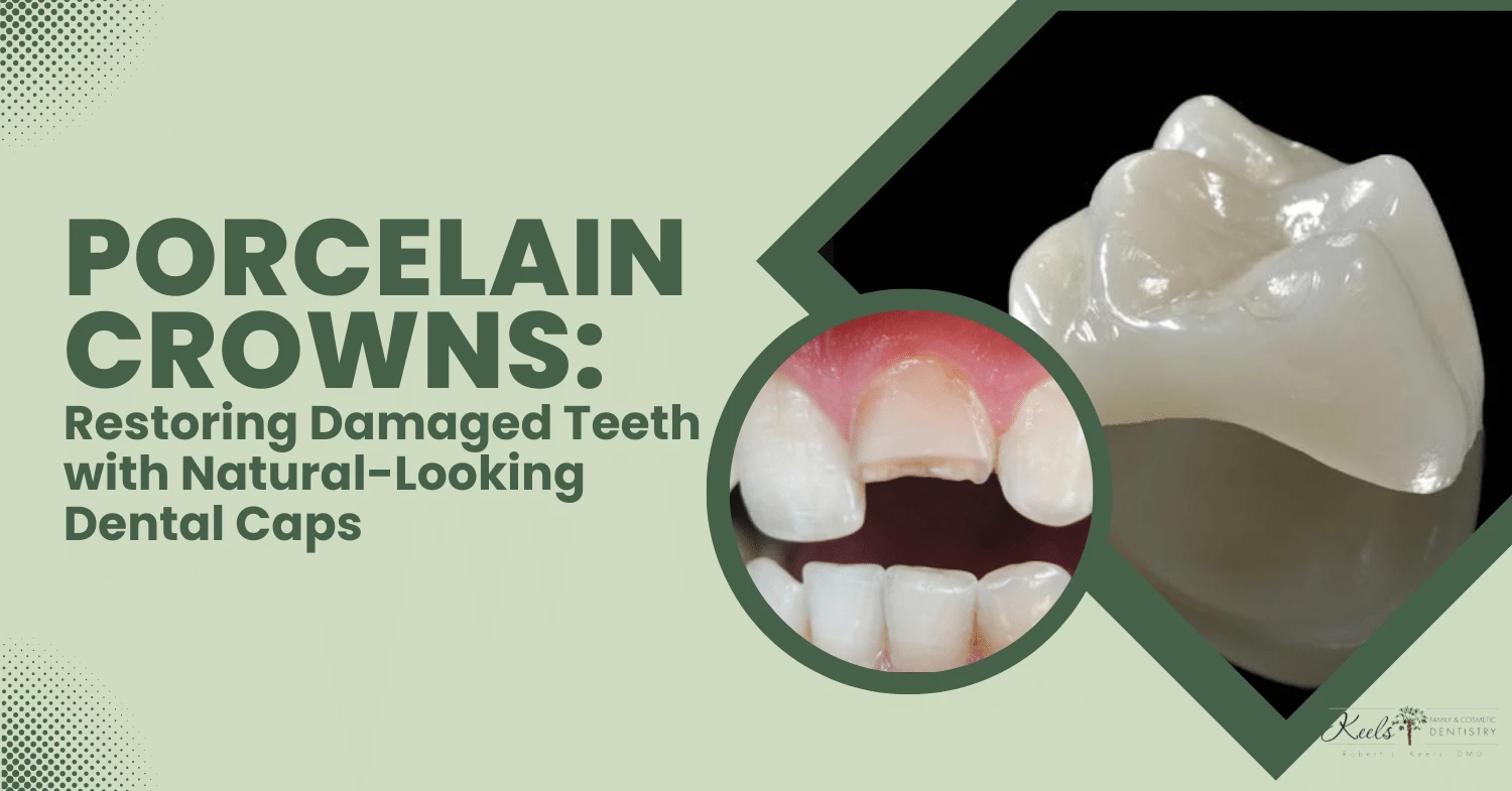 Porcelain Crowns Restoring Damaged Teeth with Natural-Looking Dental Caps