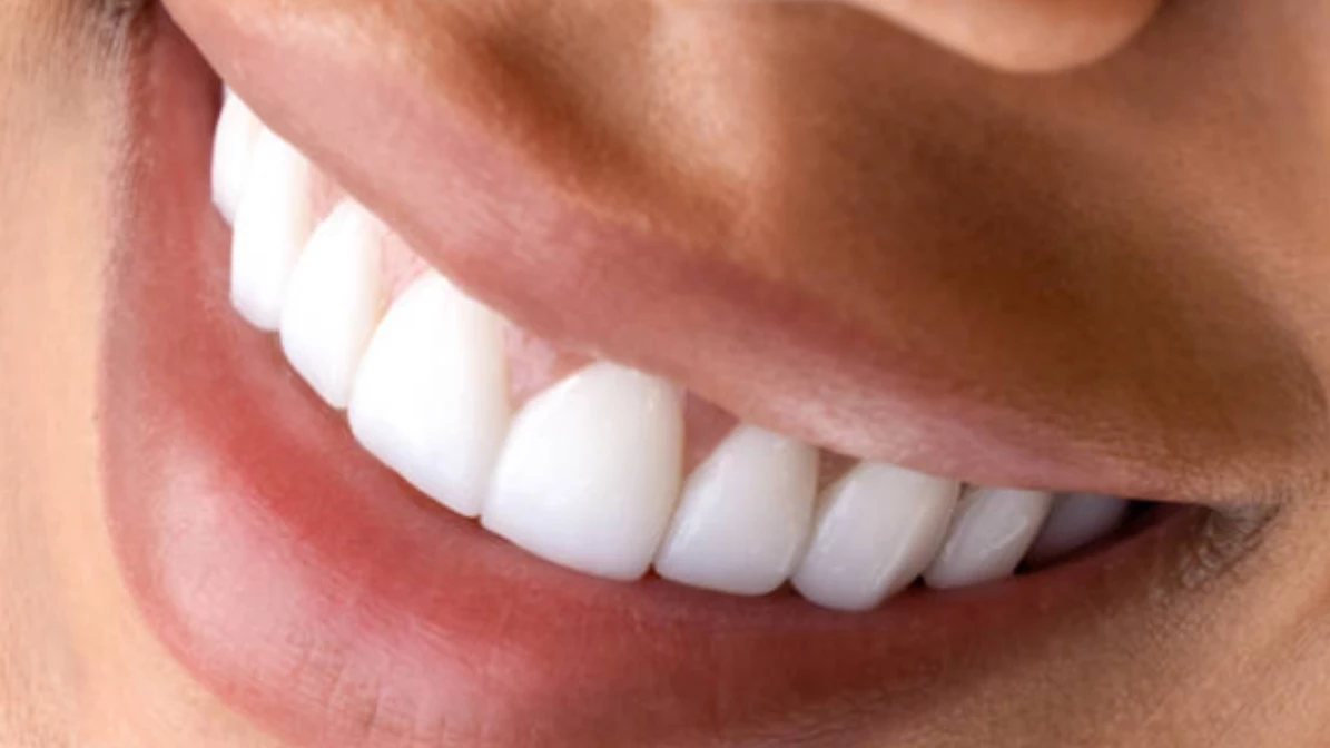The Truth About Teeth Whitening A Cosmetic Dentist's Perspective